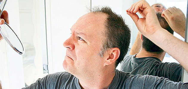 naturally regrow hair loss